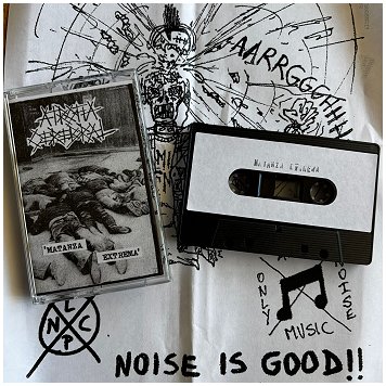 ATROFIA CEREBRAL \"Matanza extrema\"