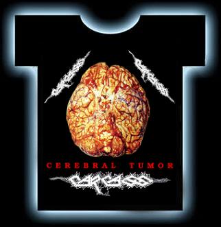 CARCASS \"Cerebral Tumor\" (t-shirt)