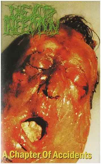 DEAD INFECTION \"A chapter of accidents\"