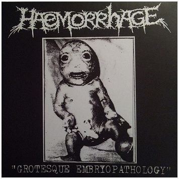 HAEMORRHAGE \"Grotesque embryopathology\"