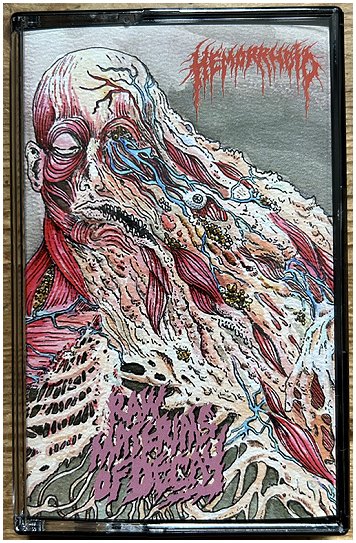 HEMORRHOID \"Raw materials of decay\"