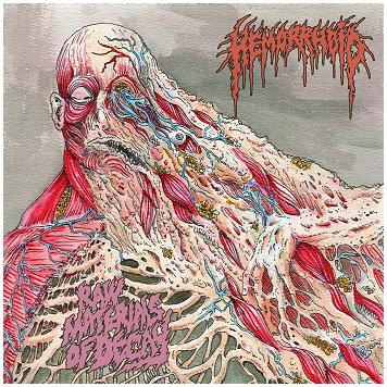 HEMORRHOID \"Raw materials of decay\"