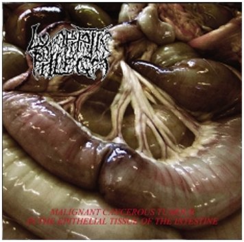 LYMPHATIC PHLEGM / FLESH GRINDER \"Split\"