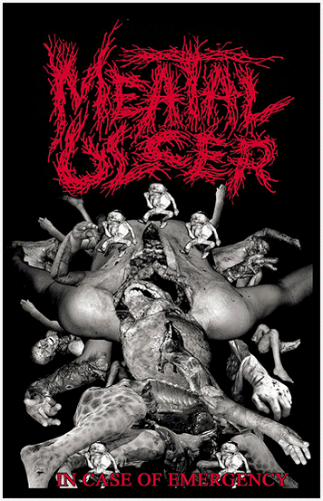 MEATAL ULCER \"In case of emergency\"