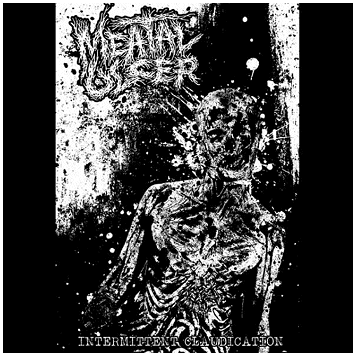 MEATAL ULCER "Intermittent claudication"