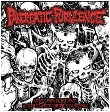 PANCREATIC PURULENCE “Complete purulent annihilation of the pancreas”