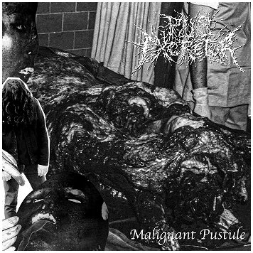 PUS EXCRETOR \"Malignant pustule\" [UK IMPORT!]