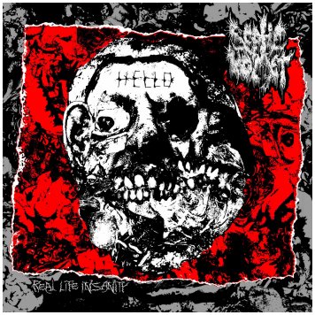 SEPTIC VOMET \"Real life insanity\"