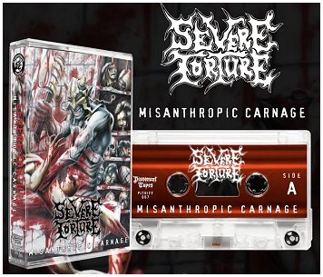 SEVERE TORTURE \"Misanthropic carnage\" [US IMPORT!]
