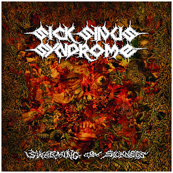 SICK SINUS SYNDROME \"Swarming of sickness\"