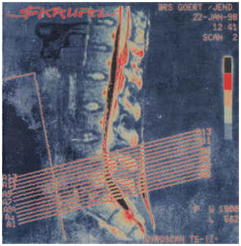 SKRUPEL \"Gyroscan T5-11\"