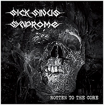 SICK SINUS SYNDROME \"Rotten to the core\"