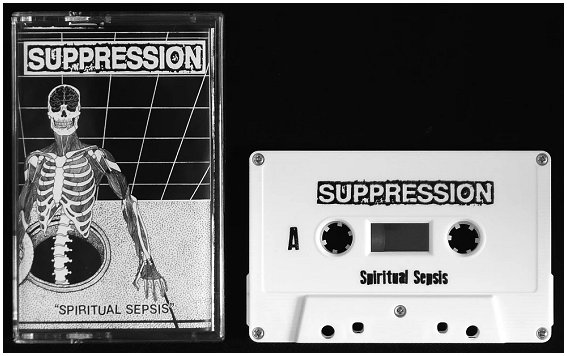 SUPPRESSION \"Spiritual sepsis\"