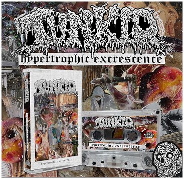 TUNKIO \"Hypertrophic excrescence\"