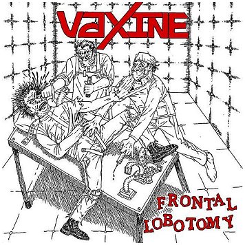 VAXINE \"Frontal lobotomy\"