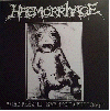 HAEMORRHAGE \"Grotesque embryopathology\"