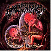 MALIGNANCY "Intrauterine cannibalism" [OXBLOOD VINYL, US IMPORT!]